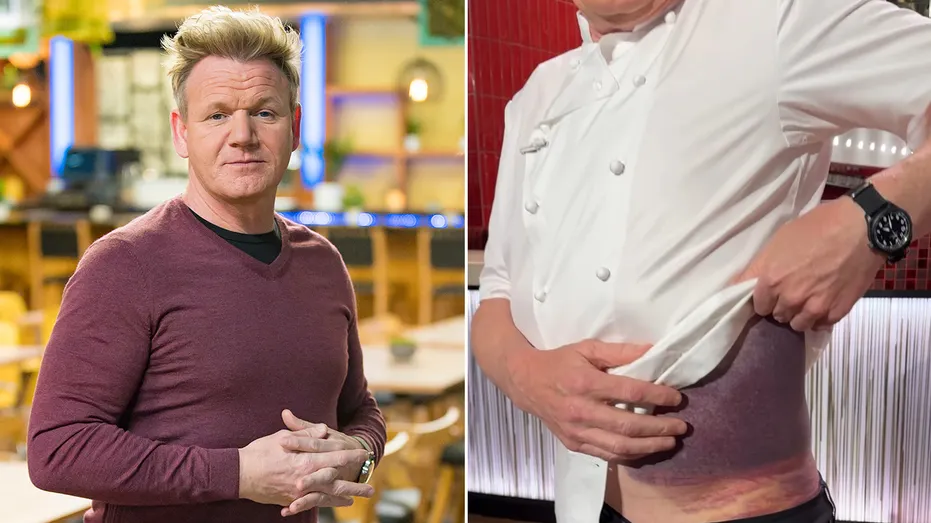 Gordon Ramsay Credits Helmet for Saving His Life After "Scary" Bike Accident