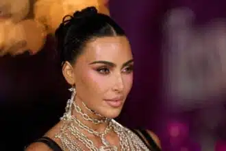 Kim Kardashian’s Aneurysm Reveal